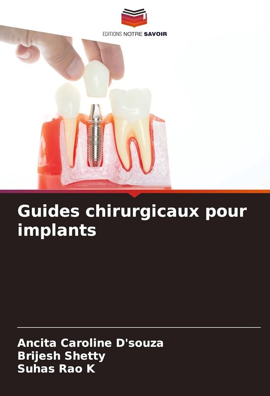 Boekomslag met een model van een tandheelkundig implantaat, getiteld: Guides chirurgicaux pour implants.