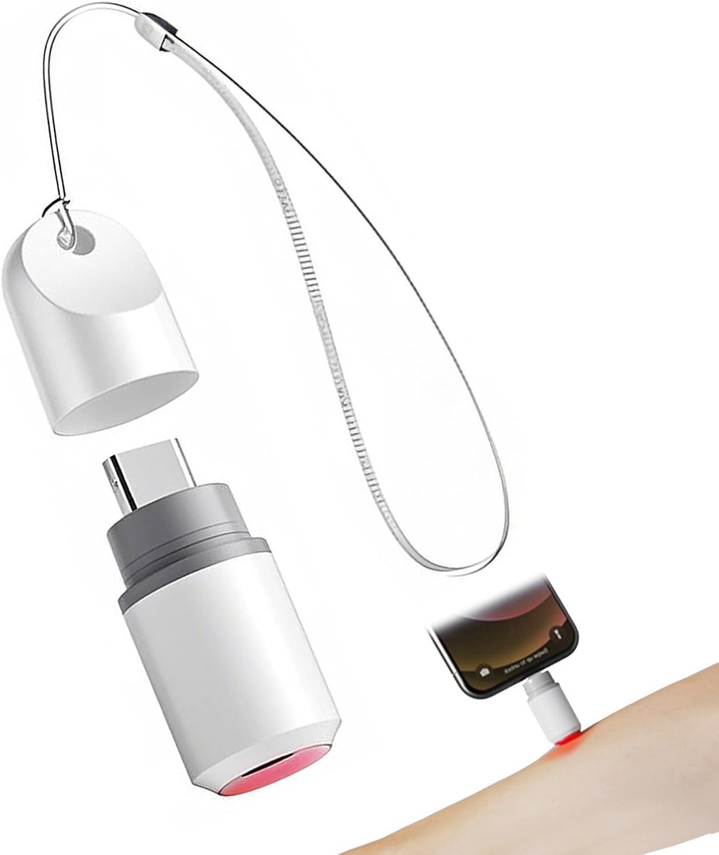 Ryoudavell - USB-C Insectenbeet Verlichter - Fysieke Warmtepen tegen jeuk
