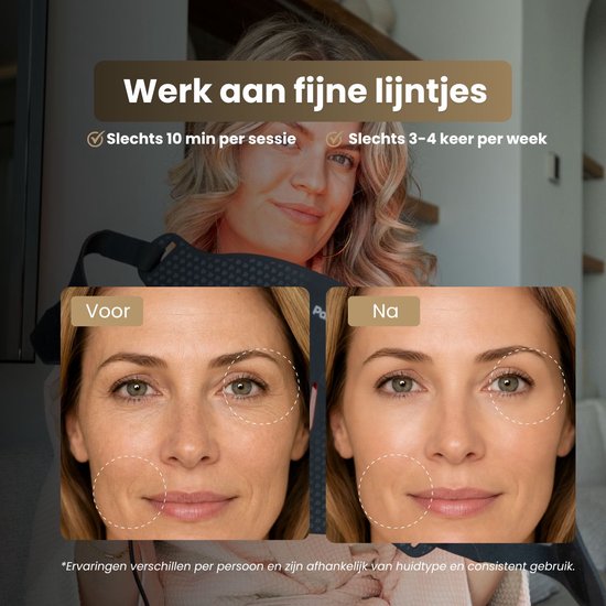 Voor en na foto's van een gezicht met fijne lijntjes, na gebruik van het Parvale LED-masker. "Werk aan fijne lijntjes", "Slechts 10 min per sessie", "Slechts 3-4 keer per week".