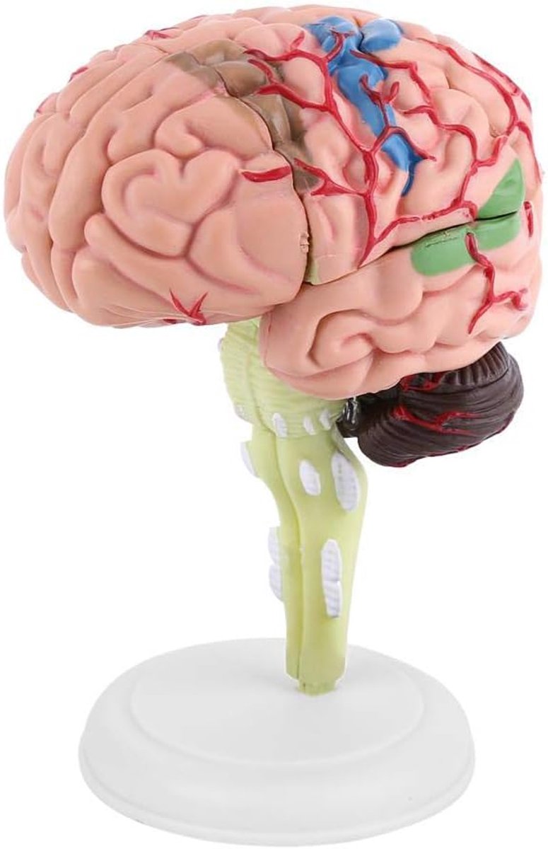 Human Brain Model Disassembled Anatomical 4D Human Brain Model 1pc Medical Biology Teaching and Learning Tool Toys - ShopVlot