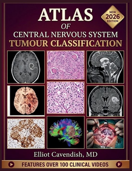 Boekomslag: Atlas of Central Nervous System Tumour Classification, 2026 editie met medische scans en chirurgische beelden.