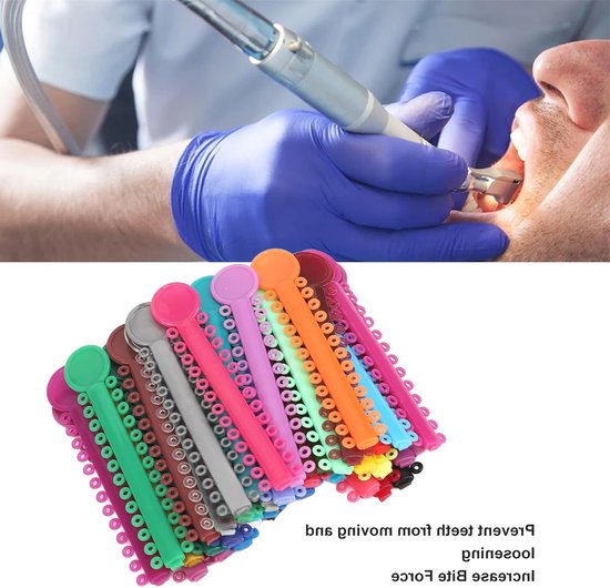 Kleurige orthodontische elastieken - 40 stuks plastic ligatuur ringen voor beugels en tandcorrectie — afbeelding 2