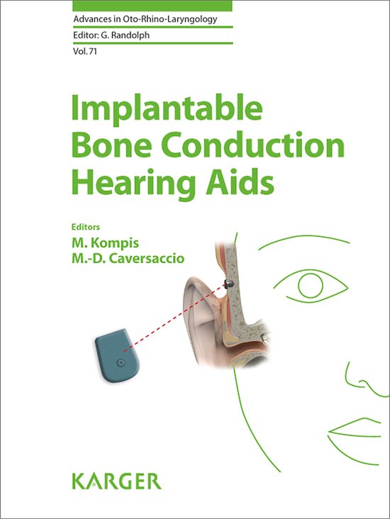 Foto: Implantable bone conduction hearing aids