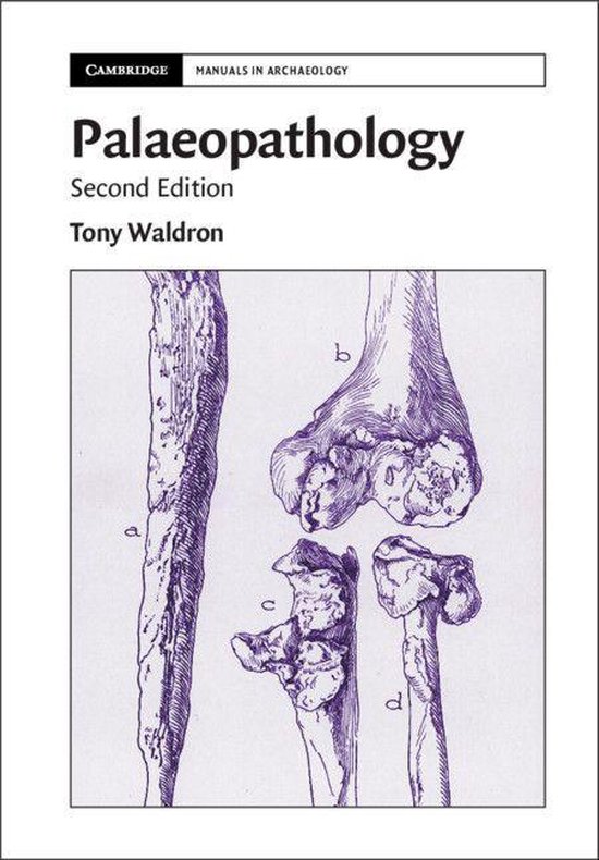 Cambridge Manuals in Archaeology - Palaeopathology - cover