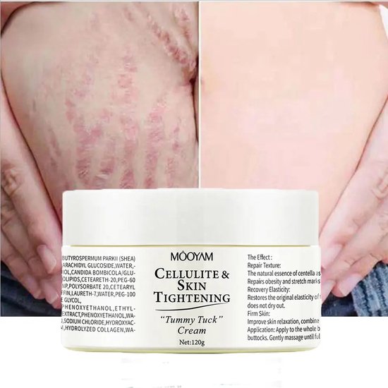 cellulite-skin-tightening-bol
