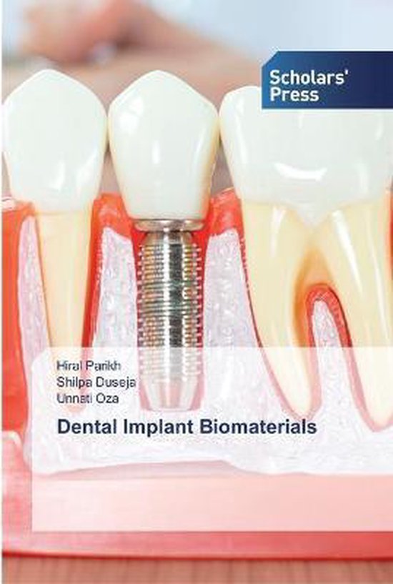 Dental Implant Biomaterials, Hiral Parikh 9786138923084 Boeken bol