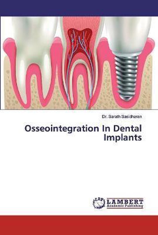 Osseointegration In Dental Implants, Sarath Sasidharan 9786200240668 Boeken