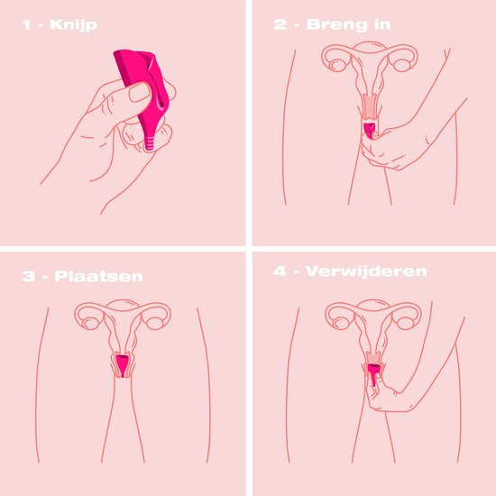 Illustration de l'insertion et du retrait d'une Lily Cup™ rose.