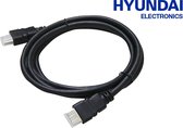 Hyundai - HDMI Audio kabel - 1,5meter - Zwart