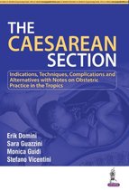 The Caesarean Section