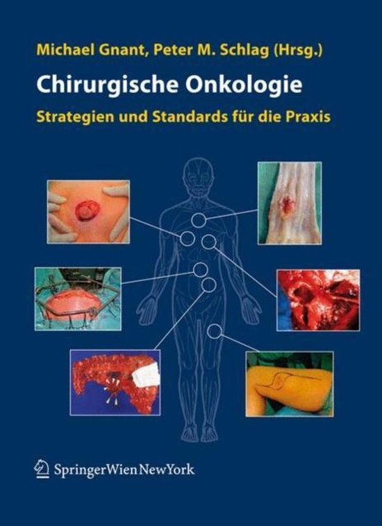 Chirurgische Onkologie - cover