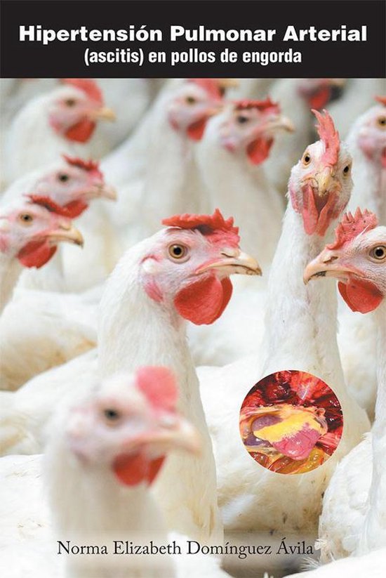 Hipertensión Pulmonar Arterial - cover