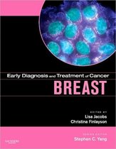 Early Diagnosis and Treatment of Cancer Series: Breast Cancer