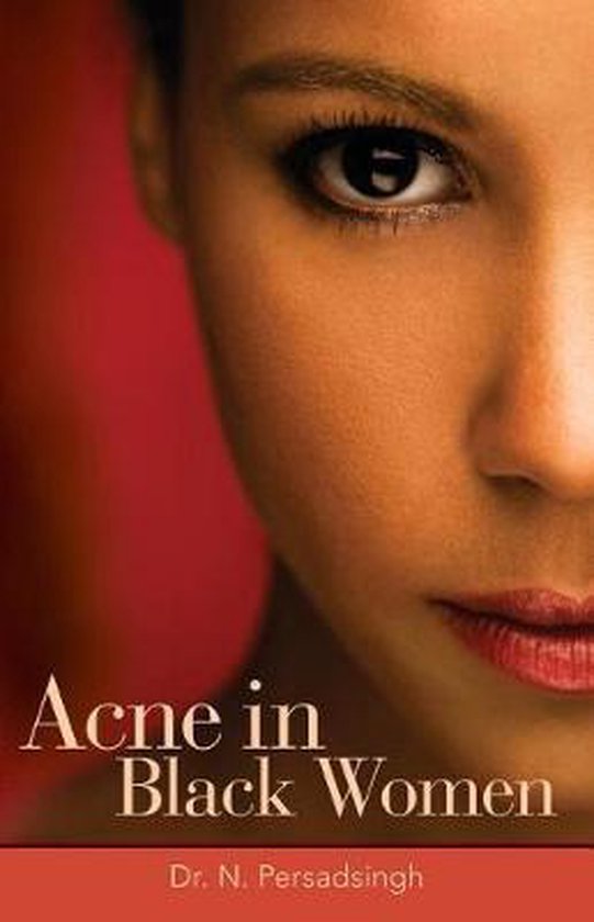 Acne in Black Women - cover