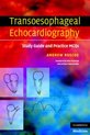 Transoesophageal Echocardiography