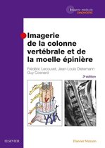 Imagerie De La Colonne Vertébrale Et De La Moelle Épinière