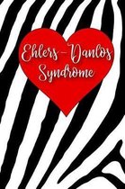 Ehler Danlos Syndrome