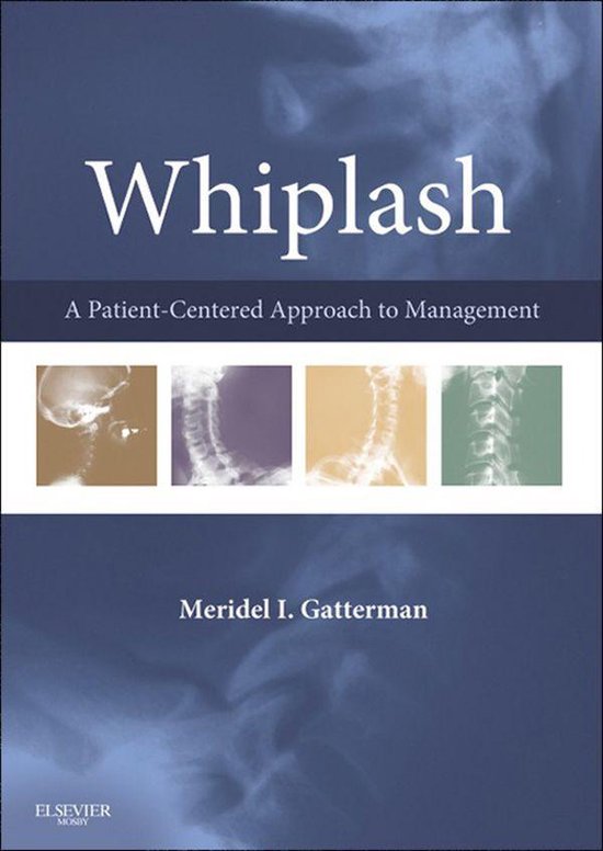 Whiplash - E-Book - cover