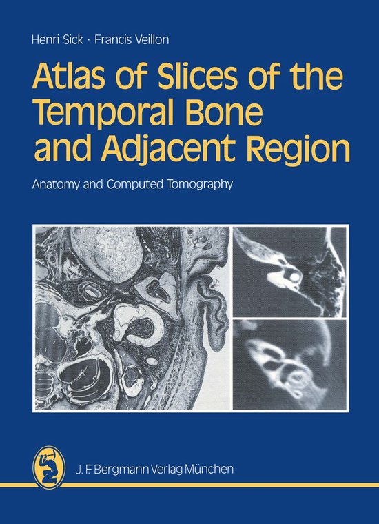 Medicine (R0) - Atlas of Slices of the Temporal Bone and Adj ... - cover