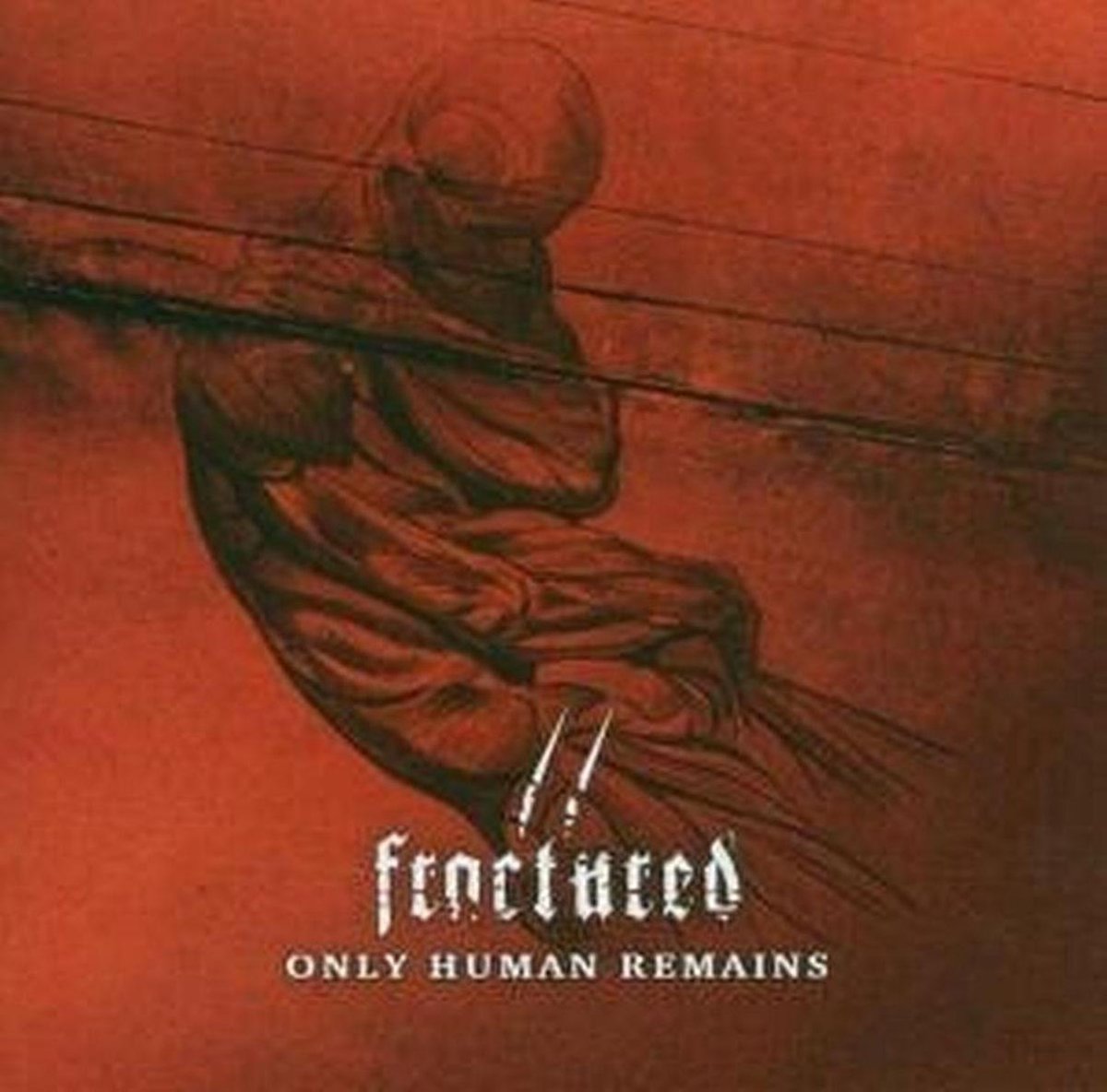 Only Human Remains