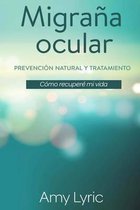 Migra a Ocular