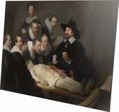 De anatomische les van Dr Nicolaes | Rembrandt van Rijn  | Plexiglas | Wanddecoratie | 90CM x 60CM | Schilderij | Oude meesters | Foto op plexiglas