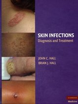 Skin Infections