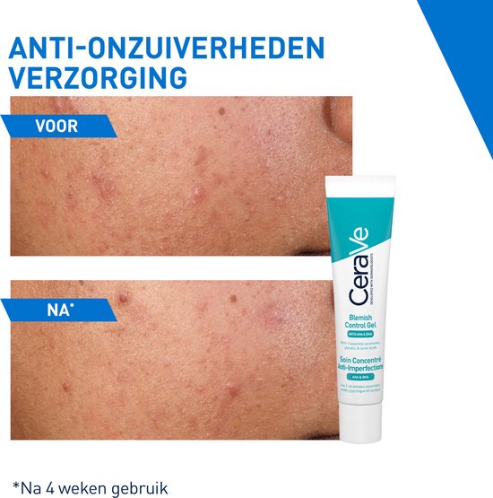 CeraVe Geconcentreerde Anti-Onzuiverheden Verzorging - voor een Onzuivere Huid met Neiging tot Acne - met 2% Salicylzuur - 40ml