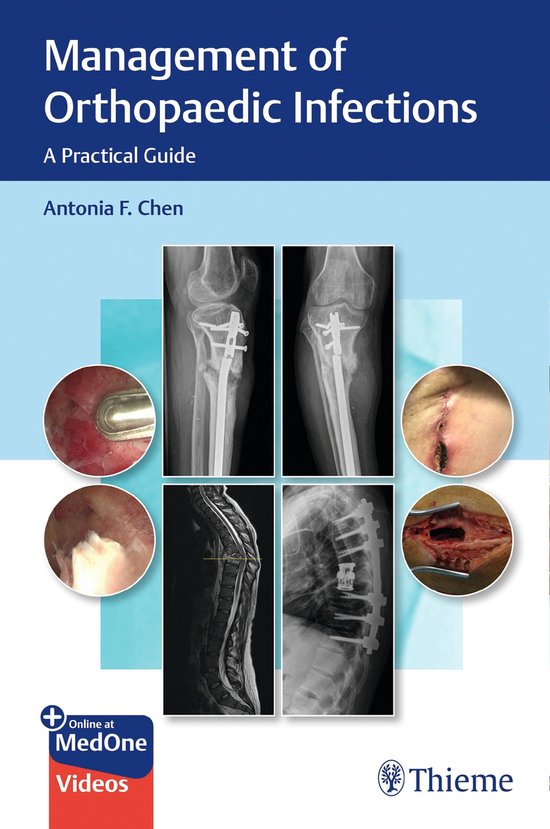 Management of Orthopaedic Infections - cover