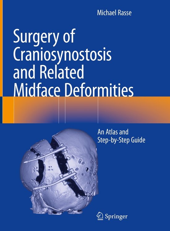 Surgery of Craniosynostosis and Related Midface Deformities - cover