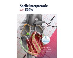 Omslag van Snelle interpretatie van ECG's