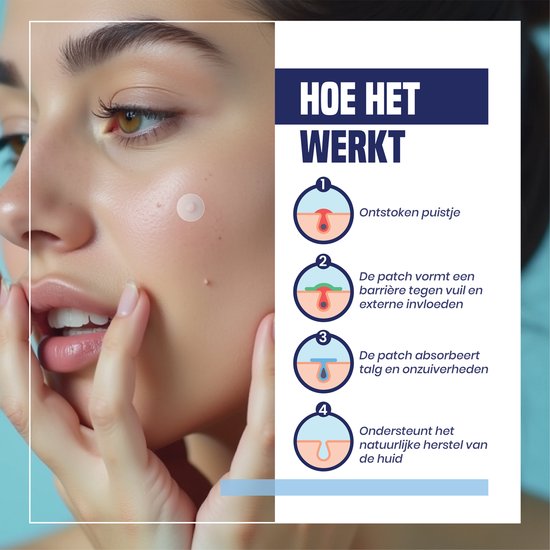 Doos Hydrocolloid Pimple Patches, 432 stuks, met tea tree olie en takjes groen.