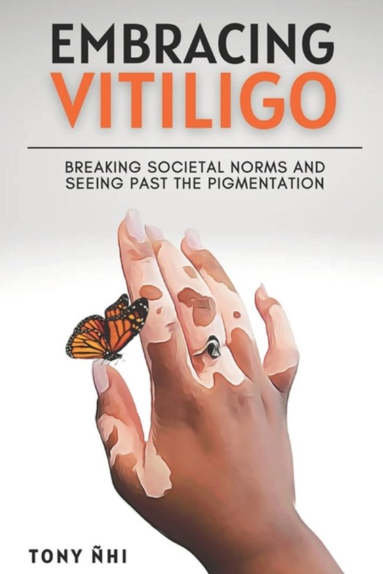 Embracing Vitiligo - cover
