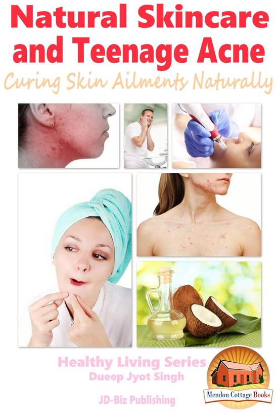 Natural Skincare and Teenage Acne - Curing Skin Ailments Nat ... - cover