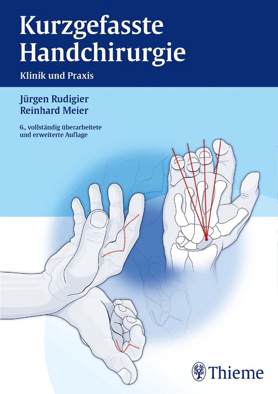 Kurzgefasste Handchirurgie - cover