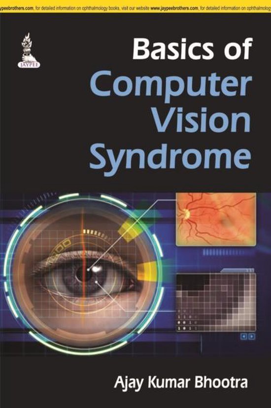 Basics of Computer Vision Syndrome 9789351524137 Ajay Kumar Bhootra