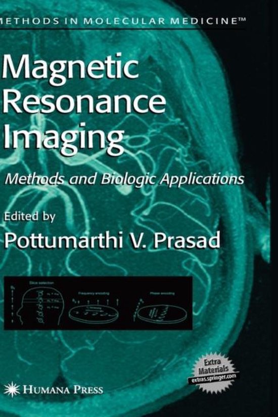 Resonance Imaging 9781588293978 Pottumarthi V. Prasad Phd