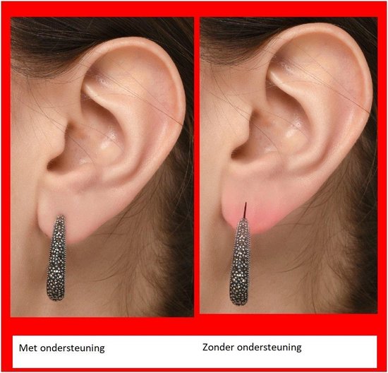 Patch de lobe d'oreille empêche les lobes d'oreilles déchirés - 60 pièces -  Boucles... | bol.com