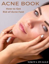 Acne Book: How to Get Rid of Acne Fast