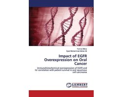 Impact of EGFR Overexpression on Oral Cancer