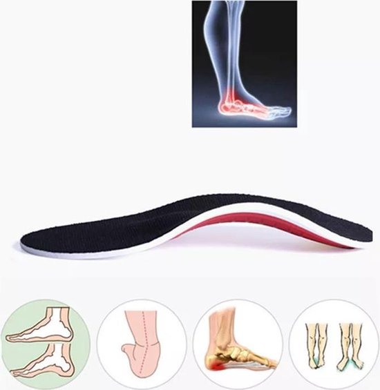 Orthopedische gel inlegzolen-high arch ondersteuning- platvoet- voetpijn |  bol.com