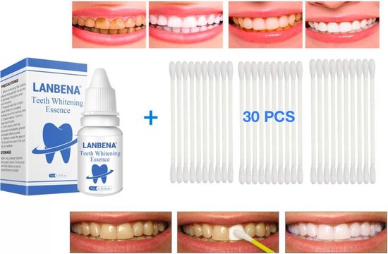 Blauwdruk eb duisternis Lanbena | Tanden bleken - tandsteen en tandplak verwijderen - verhelpt  parodontitis - ... | bol.com