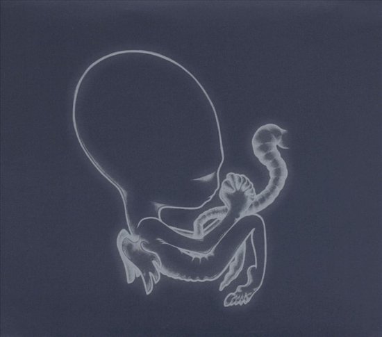Agaetis Byrjun