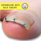 Nagelbeugel - Ingegroeide teennagel Correctie