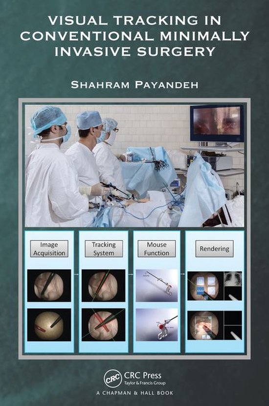 Visual Tracking in Conventional Minimally Invasive Surgery - cover