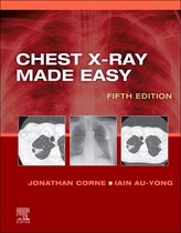 Made Easy - Chest X-Ray Made Easy E-Book