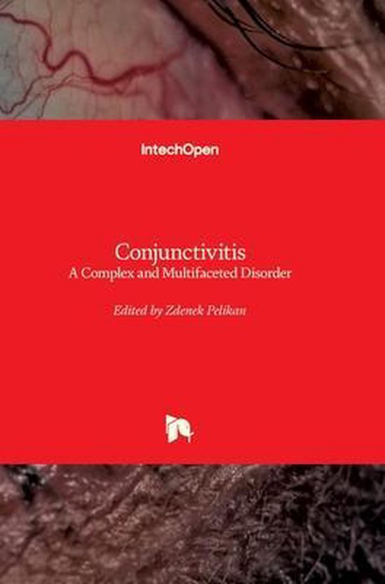 Conjunctivitis 9789533077505 Zdenek Pelikan Boeken 