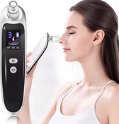 Blackhead Remover Vacuum - Mee Eters Verwijderen - 3 Snelheden - Mee eter Verwijderaar - Puisten Verwijderaar - Gezichtsreiniger - Oplaadbaar