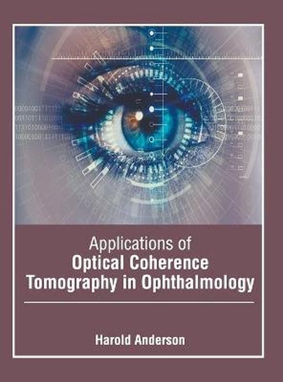 Applications of Optical Coherence Tomography in Ophthalmology 9781639870530 Boeken