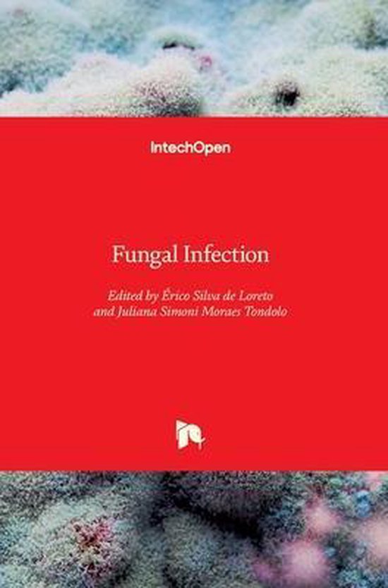 Fungal Infection 9781838804688 Erico Silva de Loreto Boeken